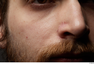 HD Face Skin Andrew Elliott cheek face nose skin pores…